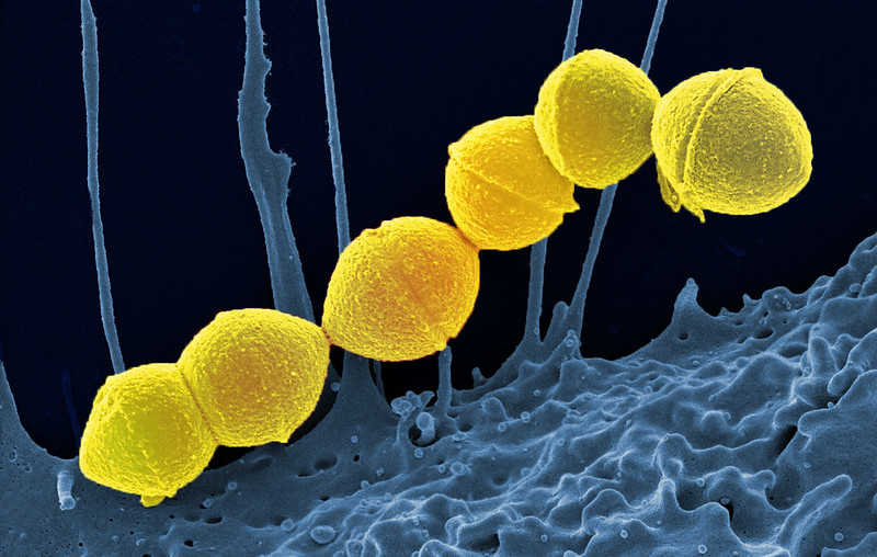 Group A streptococcus as imaged via an electron microscope